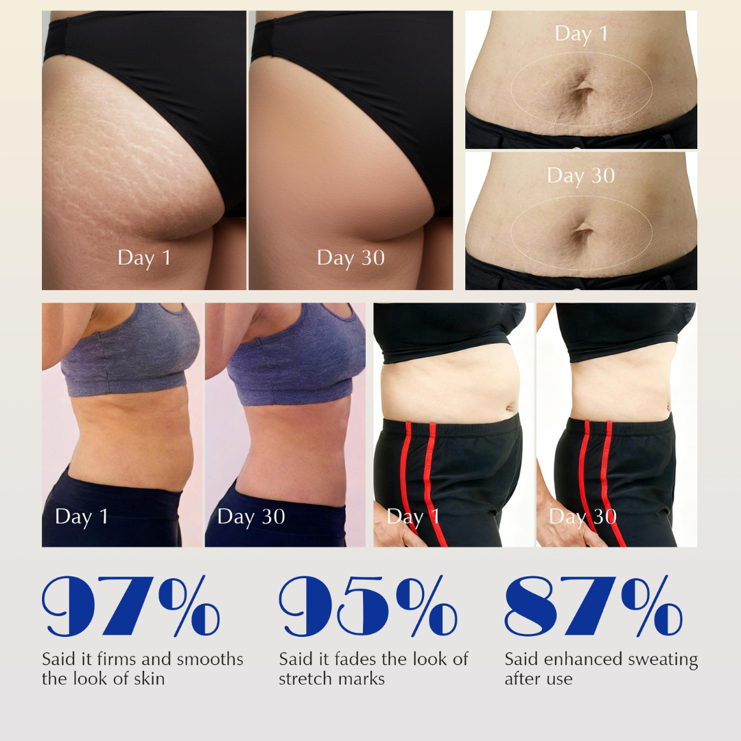 Expressions Wellness Cryo Thermo Firming Gold Gel – Infused with 24K Gold – Firms, Tightens & Transforms Skin – Reduces Stretch Marks, Wrinkles & Cellulite – For Belly, Arms, Thighs & Body Contouring