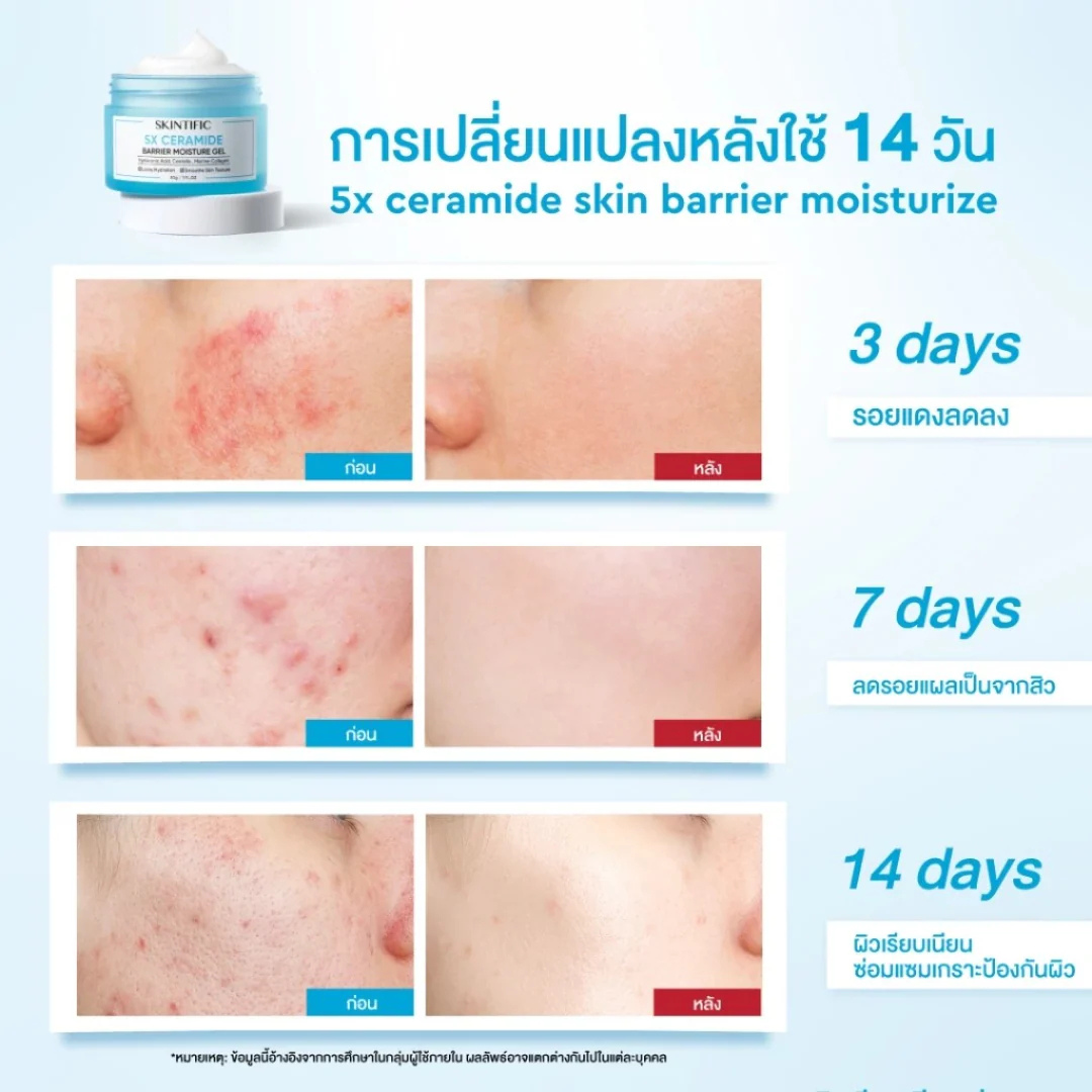 SKINTIFIC 5X Ceramide Barrier Moisture Gel | Hyaluronic Acid + Centella + Marine Collagen | Deep Hydration, Calms Redness & Repairs Skin Barrier