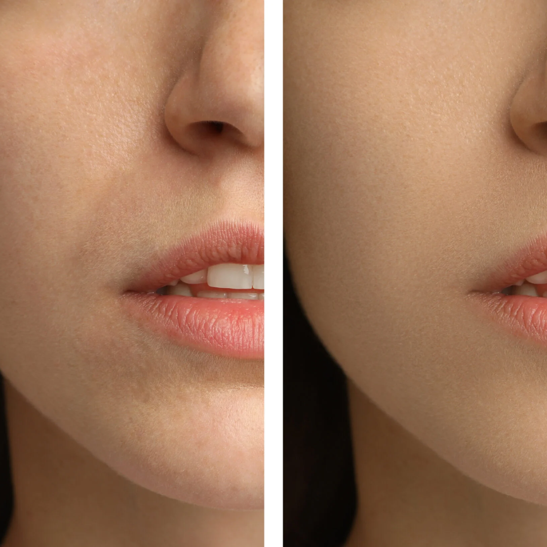 Anua PDRN 100 Hyaluronic Acid Hydrating Capsule Mist | Deep Moisture + Youthful Glow, Plumping & Glass Skin Mist