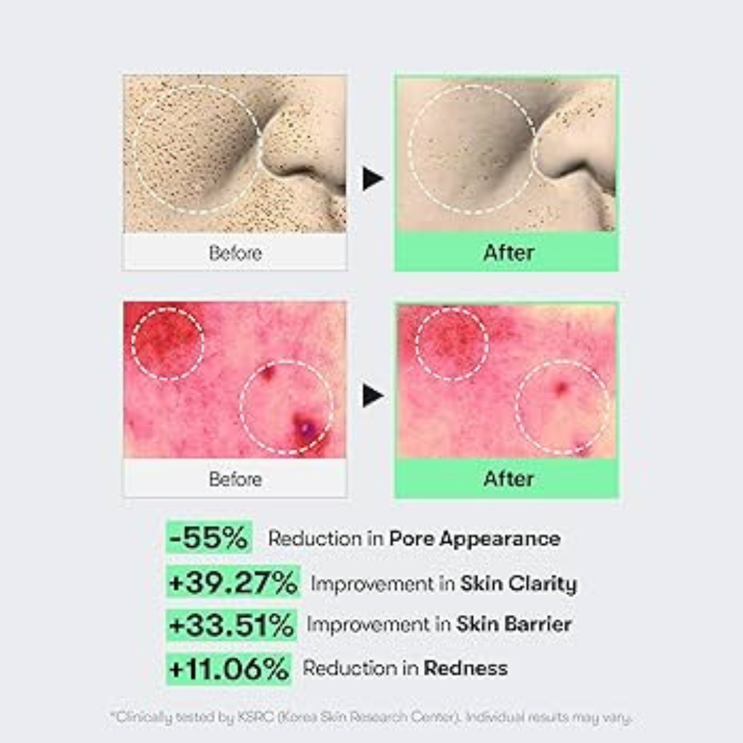 VT Cosmetics Cica Reedle Shot 100 | Micro-Needling Serum with 95,000 Cica Reedles | Smooths Texture, Boosts Absorption & Repairs Skin Barrier