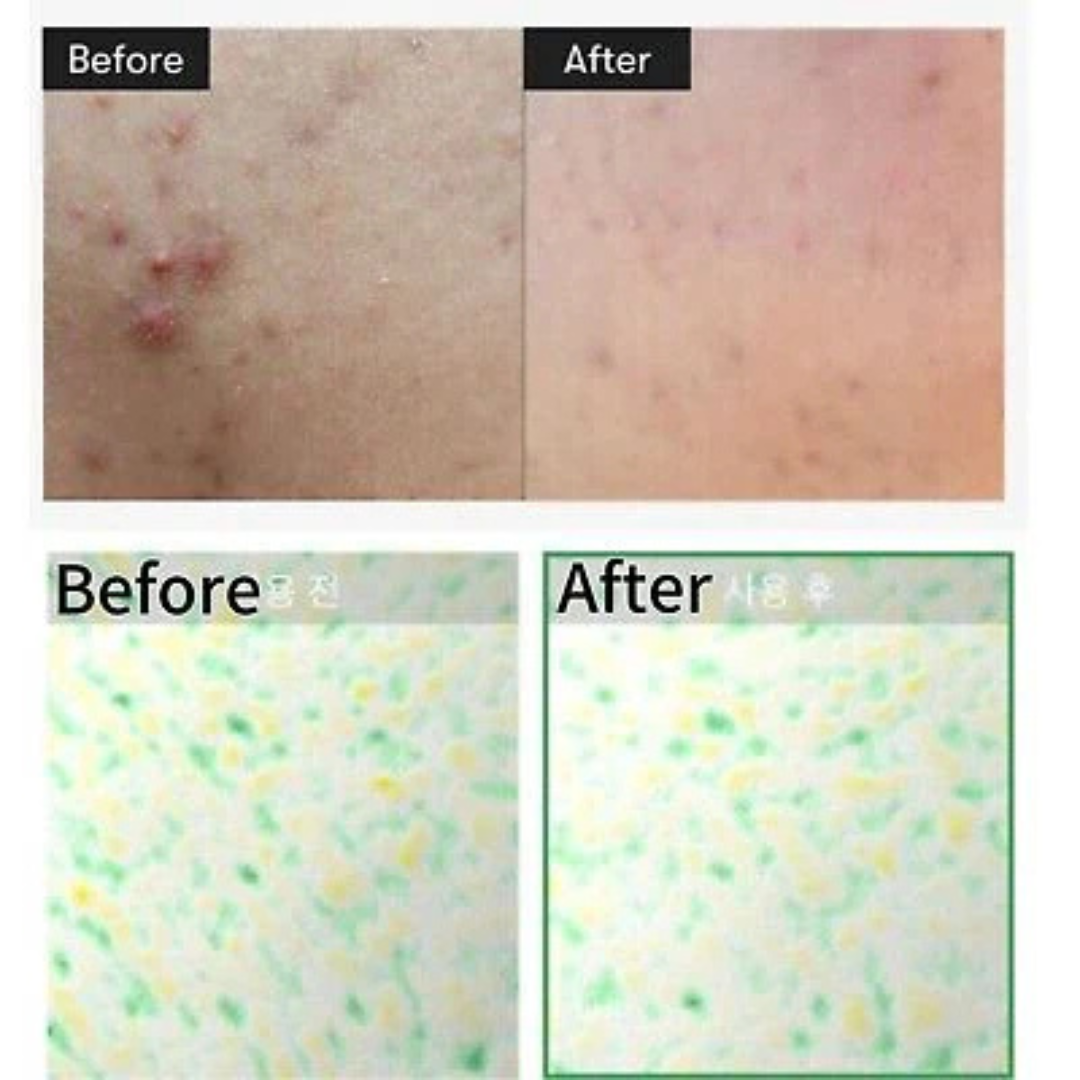 VT Cosmetics Cica Reedle Shot 100 | Micro-Needling Serum with 95,000 Cica Reedles | Smooths Texture, Boosts Absorption & Repairs Skin Barrier