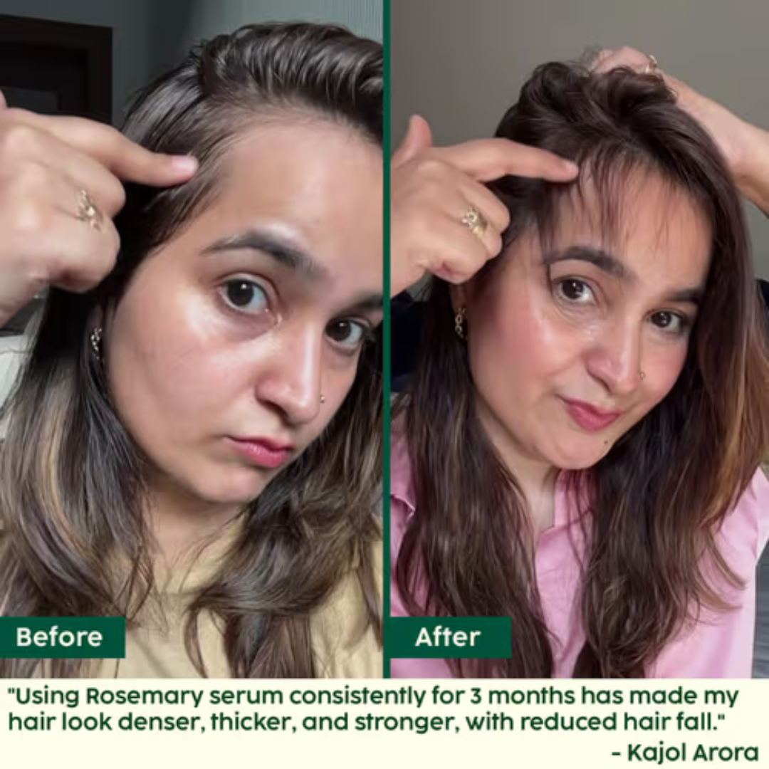 Plix Rosemary Hair Growth Advanced Hair Spray | Redensyl + Aquaxyl + Rosemary Oil | Reduces Hair Fall, Boosts Growth & Strengthens Roots