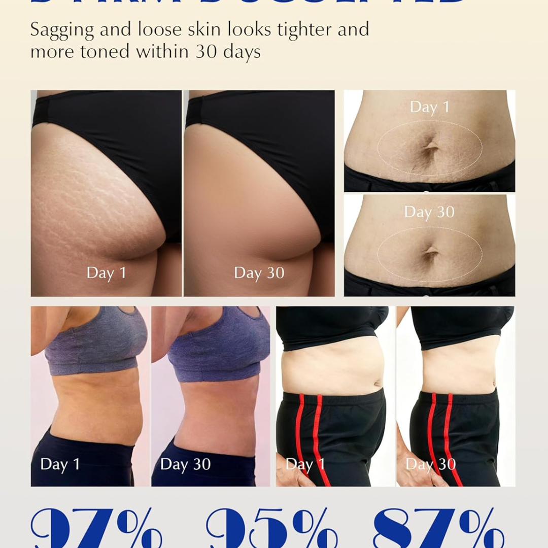 Cryo Thermo Firming Gold Gel – Firms, Tightens & Smooths Cellulite – Fades Stretch Marks – Infused with Nano Gold, Aloe Vera & Witch Hazel – For Thighs, Buttocks, Belly & Arms