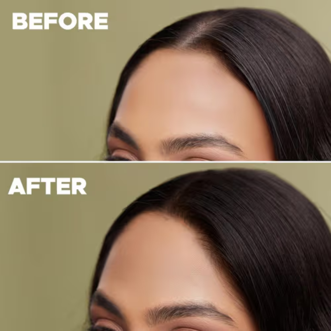 Plix Rosemary Hair Growth Advanced Hair Spray | Redensyl + Aquaxyl + Rosemary Oil | Reduces Hair Fall, Boosts Growth & Strengthens Roots
