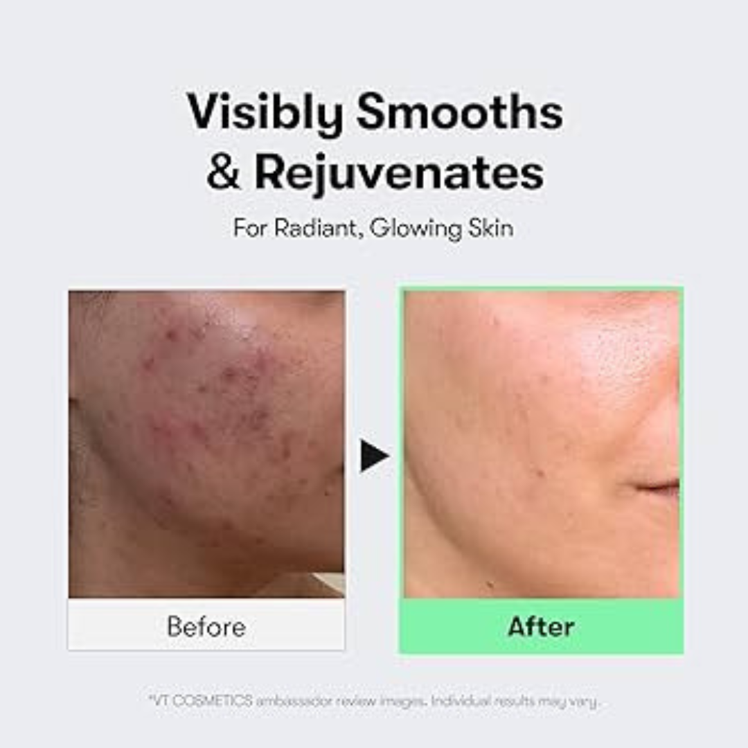 VT Cosmetics Cica Reedle Shot 100 | Micro-Needling Serum with 95,000 Cica Reedles | Smooths Texture, Boosts Absorption & Repairs Skin Barrier