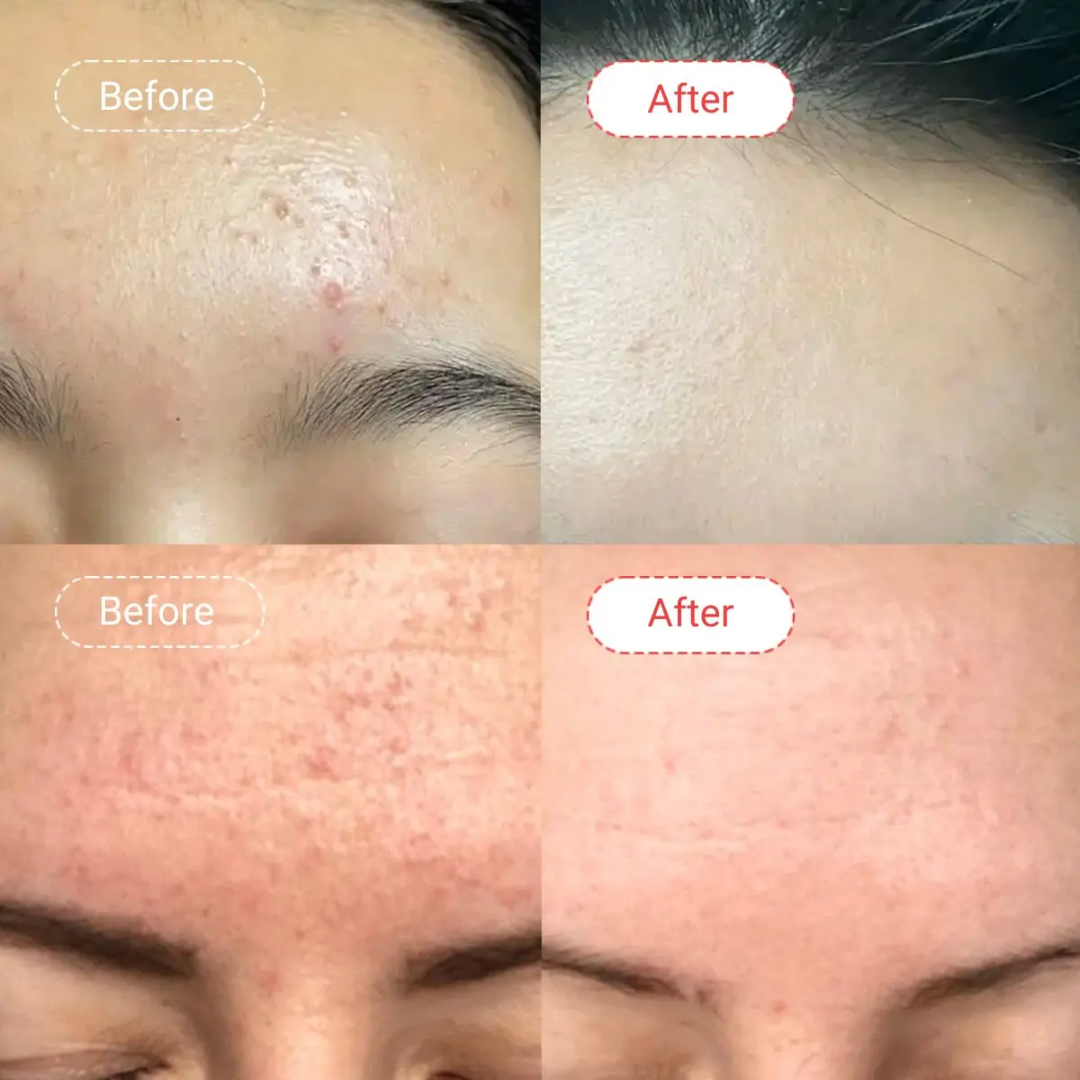 Arencia Fresh Red Glow Booster Serum - Even, Bright & Glass Skin
