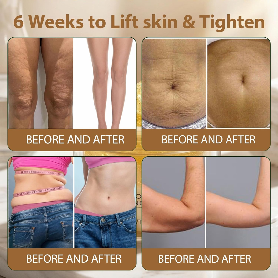 Cryo Thermo Firming Gold Gel – Firms, Tightens & Smooths Cellulite – Fades Stretch Marks – Infused with Nano Gold, Aloe Vera & Witch Hazel – For Thighs, Buttocks, Belly & Arms