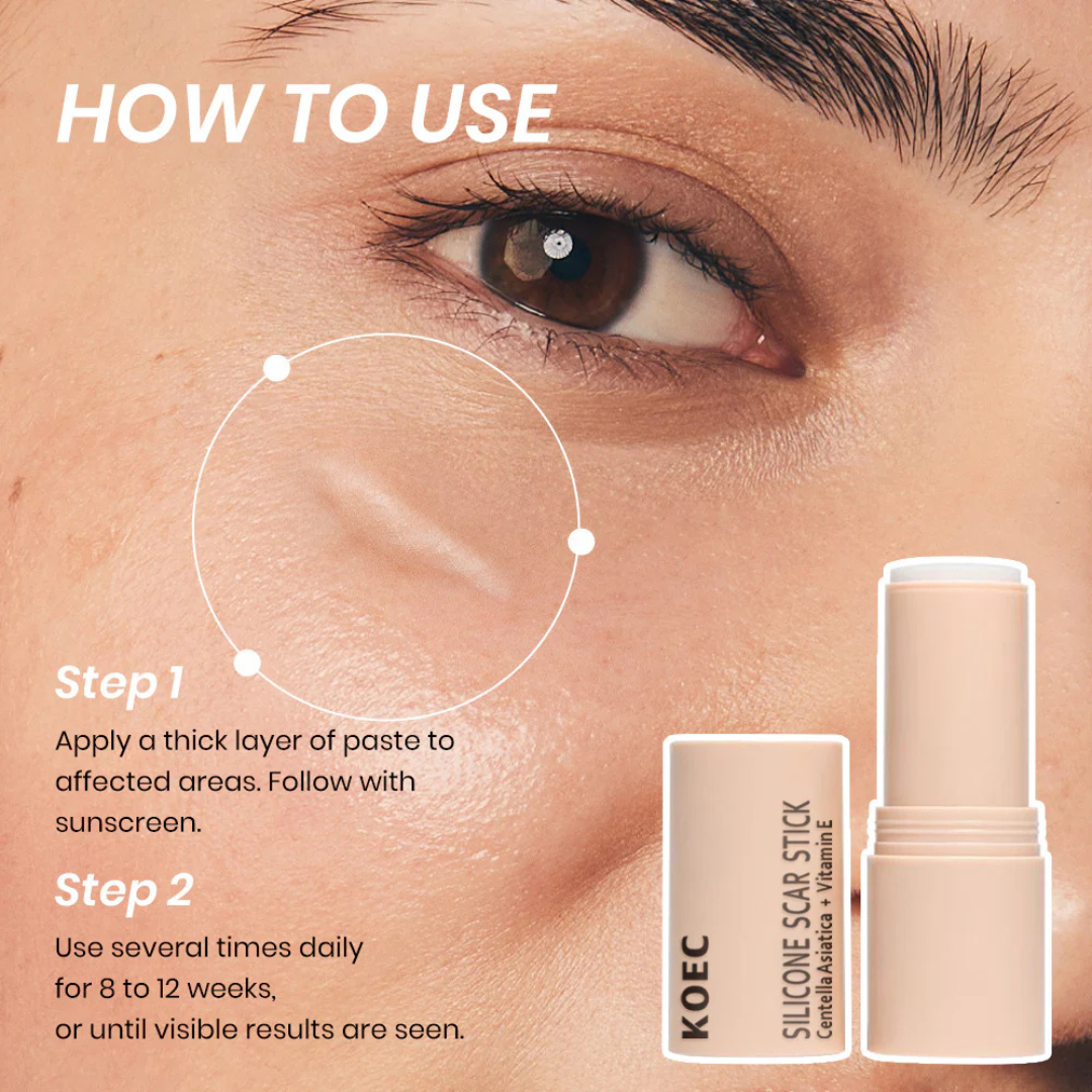Prequel Scar Solutions Silicone Scar Stick | 60% Silicone + Onion Bulb Ferment + Centella Asiatica | Reduces Scar Thickness, Redness & Improves Texture