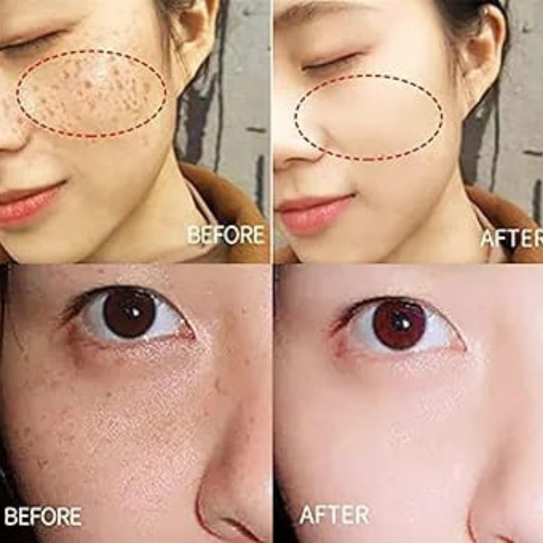 Axis-y Pore Clarifying & Acne treatment Mask | Gently clean pores & remove ance | bright & clean skin