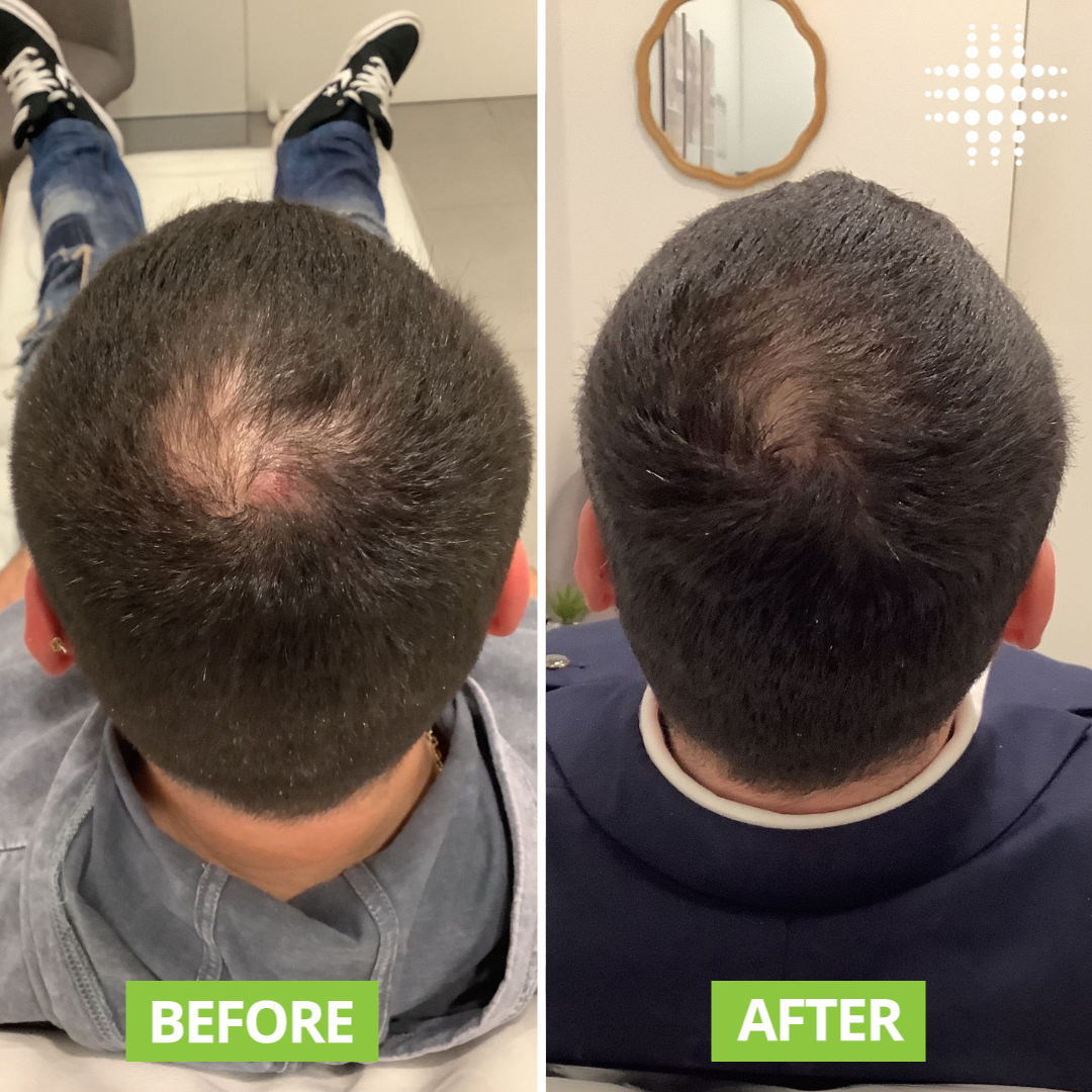 Desi Khazanay Hair Growth Oil + Ayurvedic Shampoo – Stops Hair Fall, Strengthens Roots, Promotes Regrowth, Reduces Dandruff – With Amla, Bhringraj, Onion Seed & Keratin