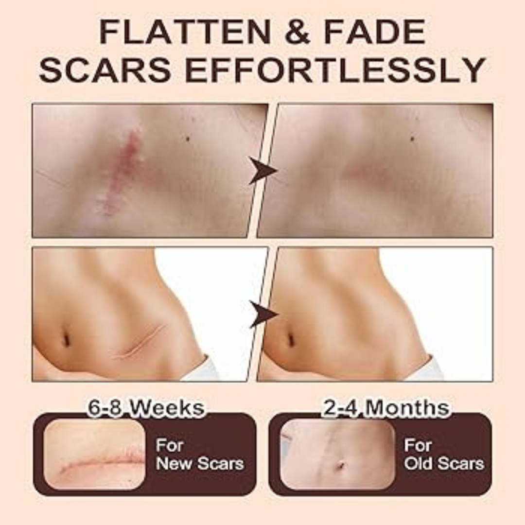 Prequel Scar Solutions Silicone Scar Stick | 60% Silicone + Onion Bulb Ferment + Centella Asiatica | Reduces Scar Thickness, Redness & Improves Texture