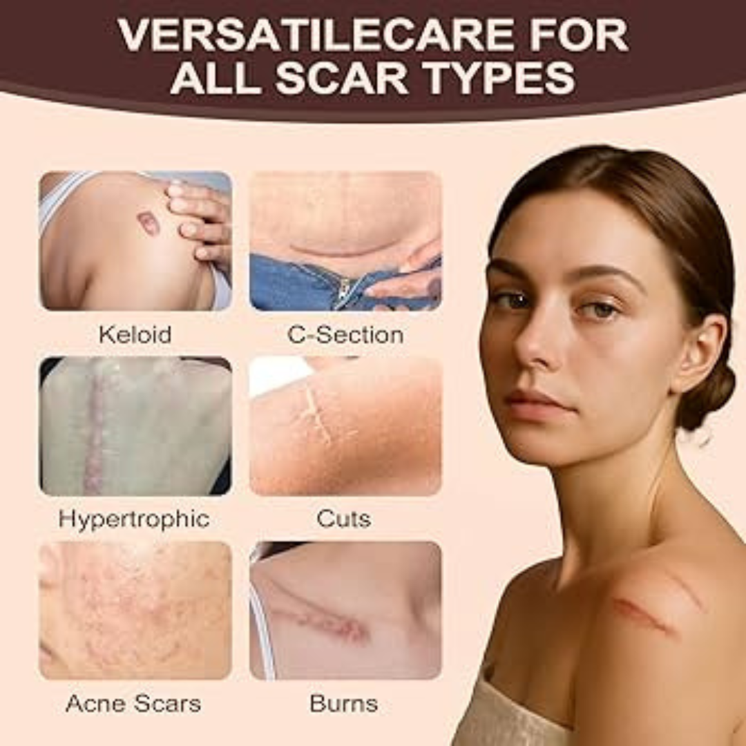 Prequel Scar Solutions Silicone Scar Stick | 60% Silicone + Onion Bulb Ferment + Centella Asiatica | Reduces Scar Thickness, Redness & Improves Texture