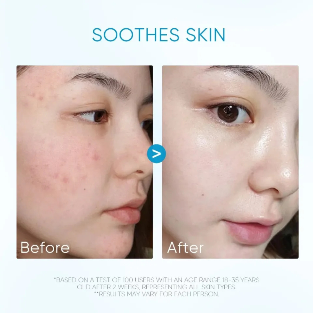SKINTIFIC 5X Ceramide Barrier Moisture Gel | Hyaluronic Acid + Centella + Marine Collagen | Deep Hydration, Calms Redness & Repairs Skin Barrier
