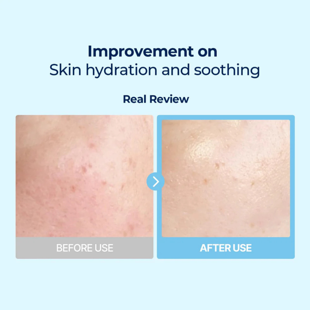 Torriden Dive In Hyaluronic Acid Serum | 5D Hyaluronic Acid Complex + Panthenol + Allantoin | 48H Deep Hydration, Soothes & Plumps Skin