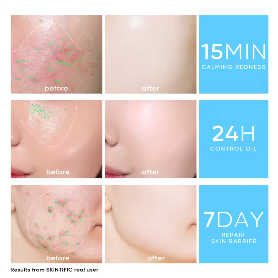 SKINTIFIC 5X Ceramide Barrier Moisture Gel | Hyaluronic Acid + Centella + Marine Collagen | Deep Hydration, Calms Redness & Repairs Skin Barrier