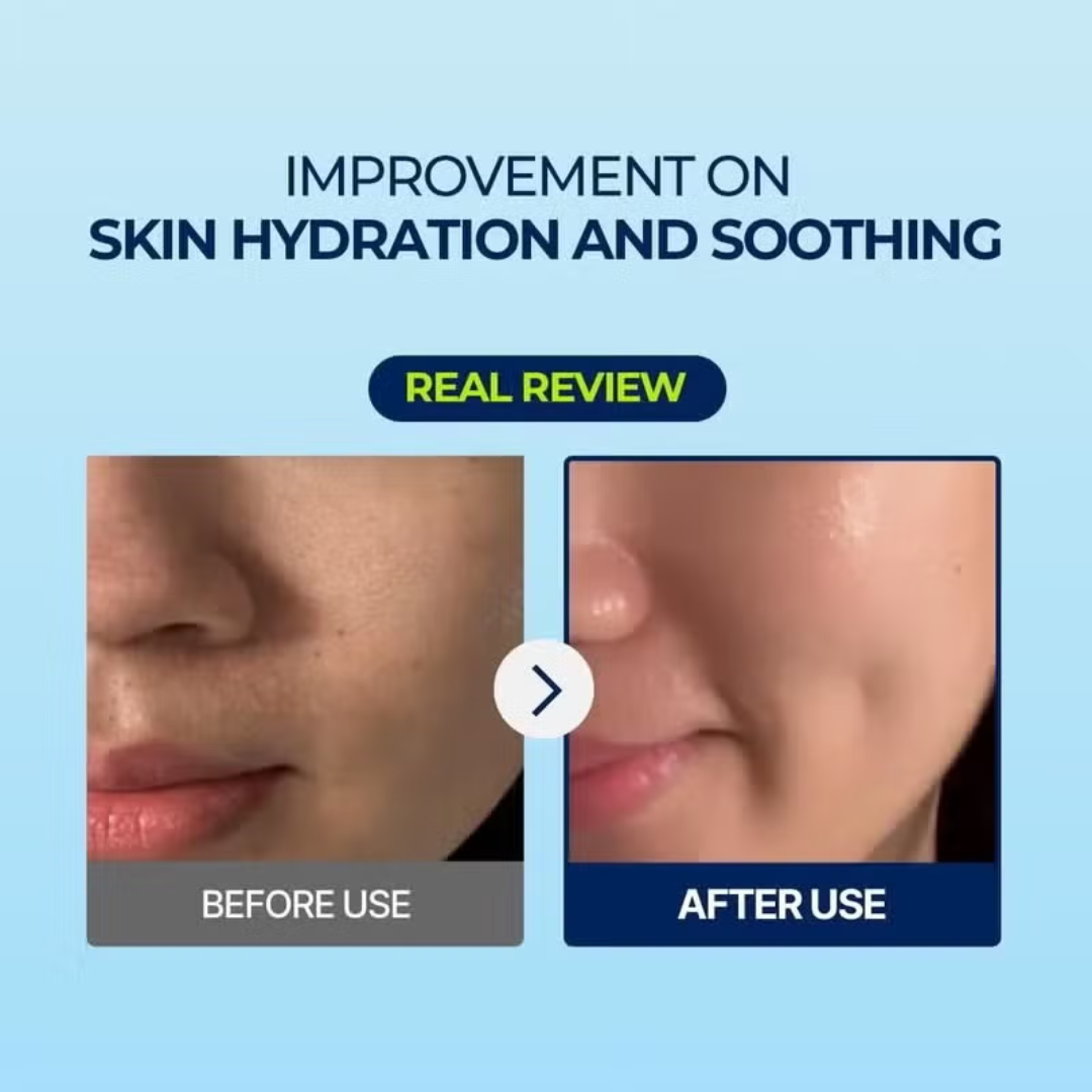 Torriden Dive In Hyaluronic Acid Serum | 5D Hyaluronic Acid Complex + Panthenol + Allantoin | 48H Deep Hydration, Soothes & Plumps Skin