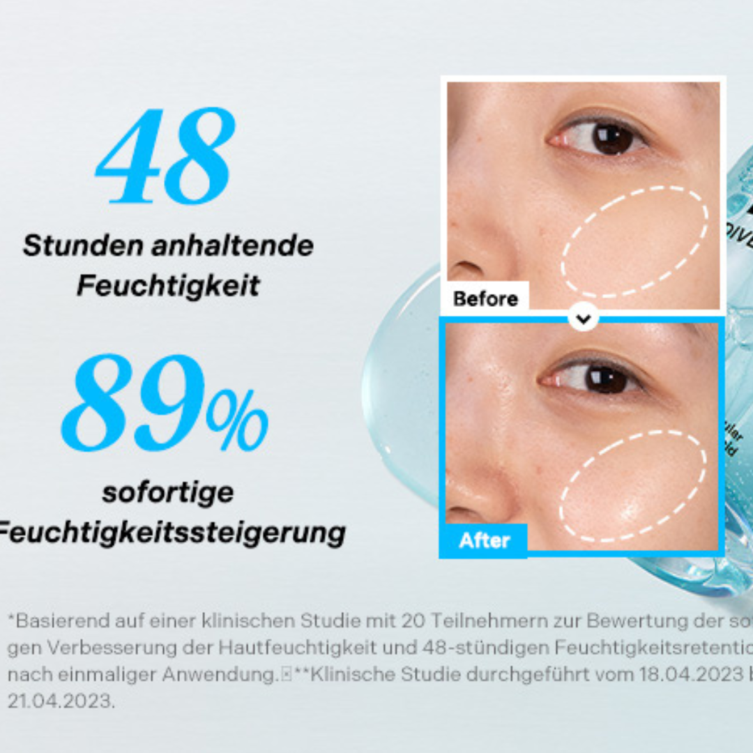 Torriden Dive In Hyaluronic Acid Serum | 5D Hyaluronic Acid Complex + Panthenol + Allantoin | 48H Deep Hydration, Soothes & Plumps Skin