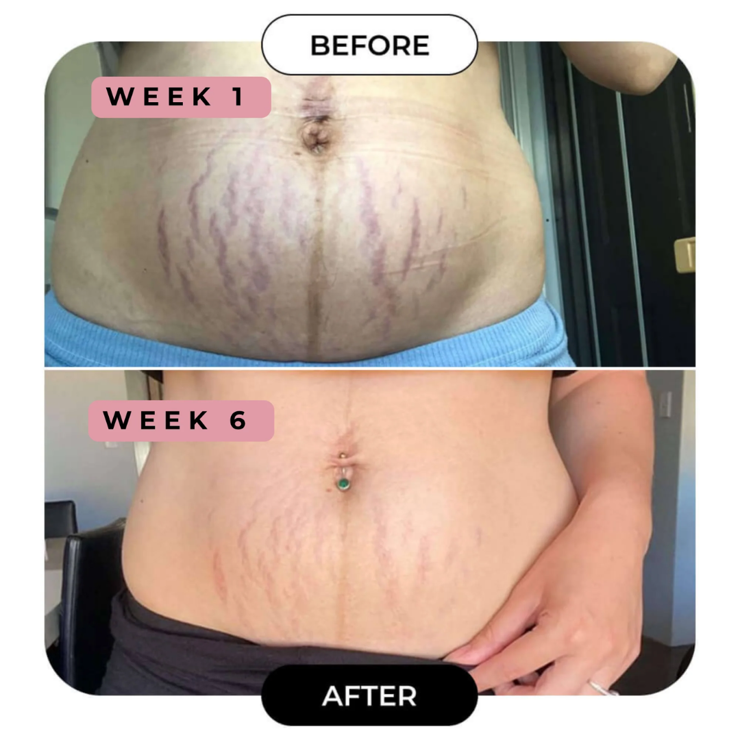 Expressions Wellness Cryo Thermo Firming Gold Gel – Infused with 24K Gold – Firms, Tightens & Transforms Skin – Reduces Stretch Marks, Wrinkles & Cellulite – For Belly, Arms, Thighs & Body Contouring