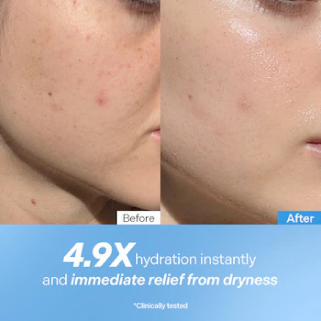 Torriden Dive In Hyaluronic Acid Serum | 5D Hyaluronic Acid Complex + Panthenol + Allantoin | 48H Deep Hydration, Soothes & Plumps Skin
