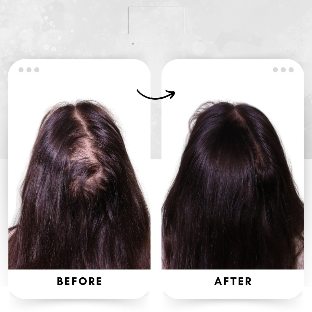 Rivaaj Mahal Herbal Hair Oil | 100% Natural Formula with 20+ Herbs | Reduces Hair Fall, Promotes Growth & Fights Dandruff