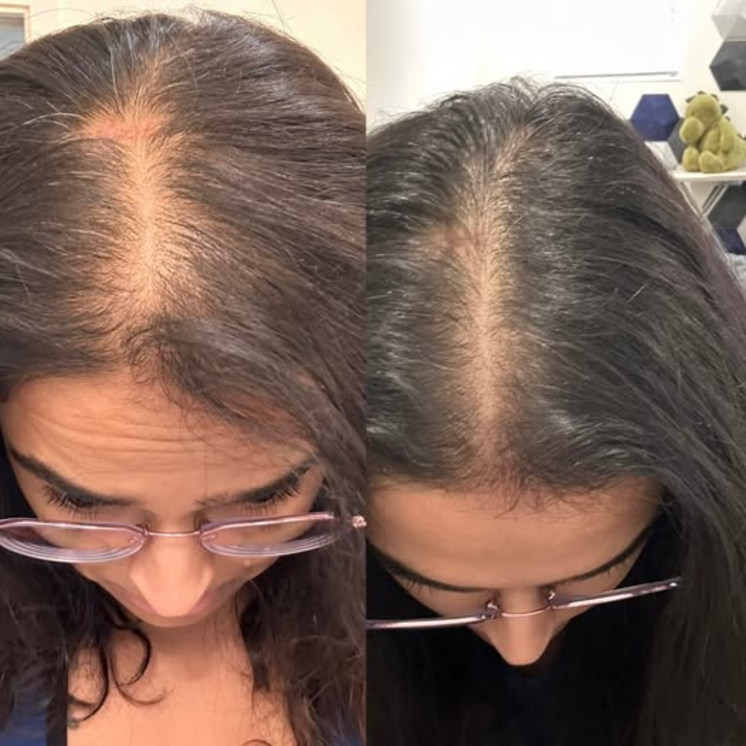 Desi Khazanay Hair Growth Oil + Ayurvedic Shampoo – Stops Hair Fall, Strengthens Roots, Promotes Regrowth, Reduces Dandruff – With Amla, Bhringraj, Onion Seed & Keratin