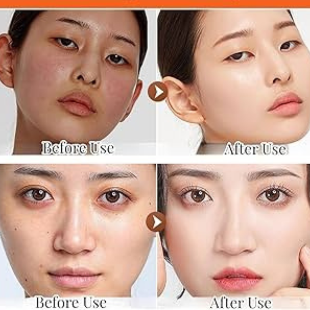 VT Cosmetics Cica Reedle Shot 100 | Micro-Needling Serum with 95,000 Cica Reedles | Smooths Texture, Boosts Absorption & Repairs Skin Barrier