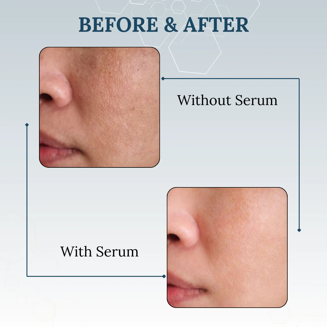 Torriden Dive In Hyaluronic Acid Serum | 5D Hyaluronic Acid Complex + Panthenol + Allantoin | 48H Deep Hydration, Soothes & Plumps Skin
