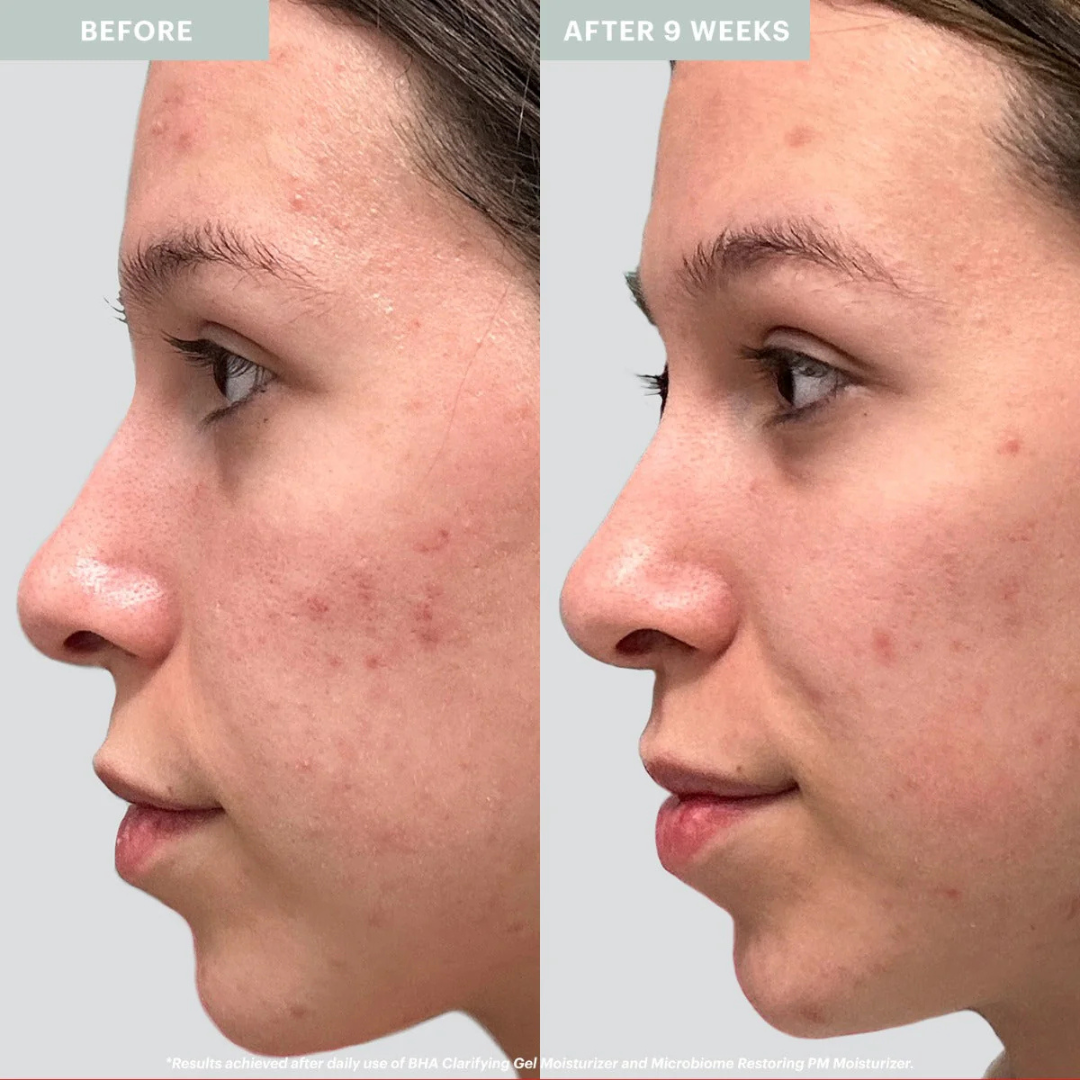 SKINTIFIC 5X Ceramide Barrier Moisture Gel | Hyaluronic Acid + Centella + Marine Collagen | Deep Hydration, Calms Redness & Repairs Skin Barrier