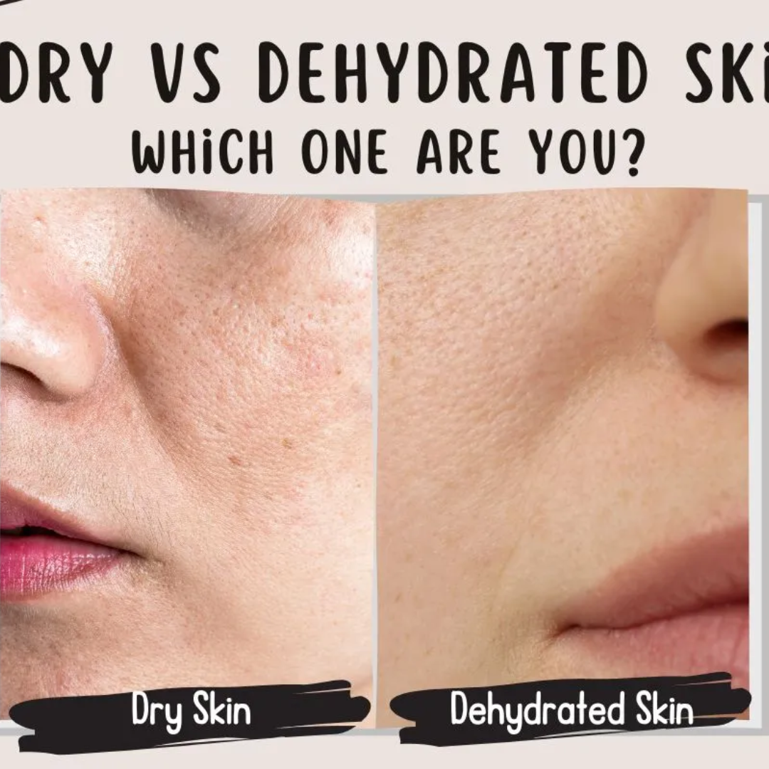Torriden Dive In Hyaluronic Acid Serum | 5D Hyaluronic Acid Complex + Panthenol + Allantoin | 48H Deep Hydration, Soothes & Plumps Skin