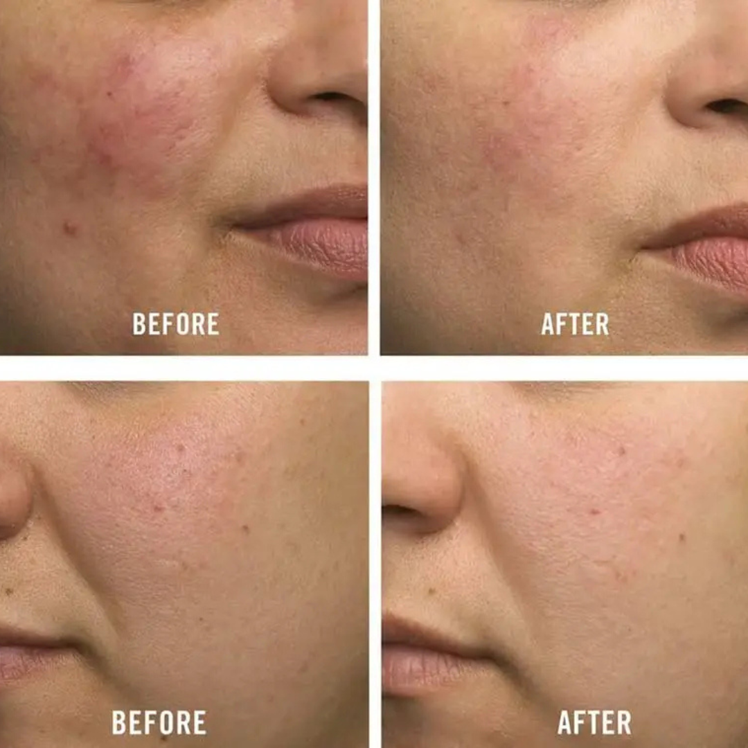 SKINTIFIC 5X Ceramide Barrier Moisture Gel | Hyaluronic Acid + Centella + Marine Collagen | Deep Hydration, Calms Redness & Repairs Skin Barrier