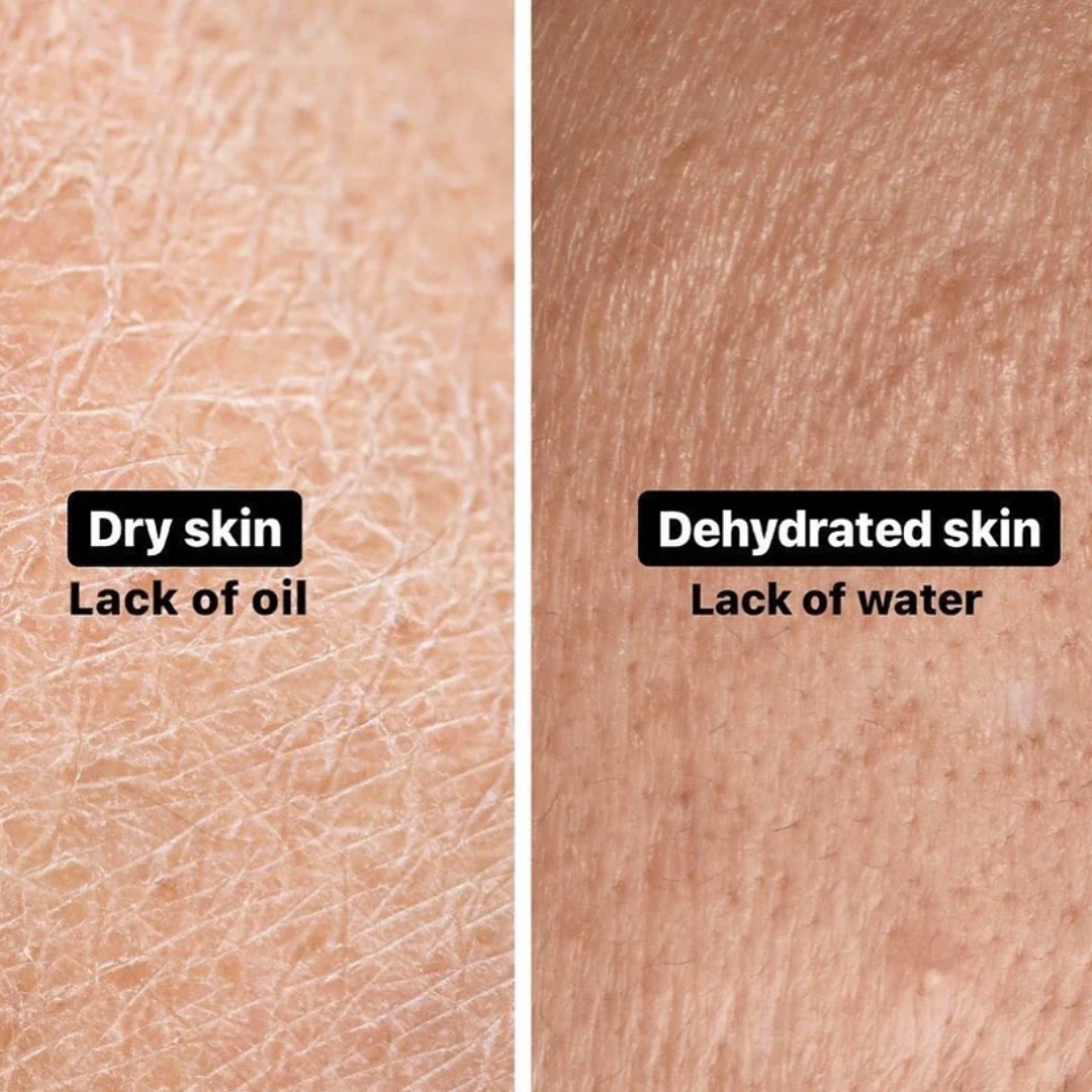 Torriden Dive In Hyaluronic Acid Serum | 5D Hyaluronic Acid Complex + Panthenol + Allantoin | 48H Deep Hydration, Soothes & Plumps Skin