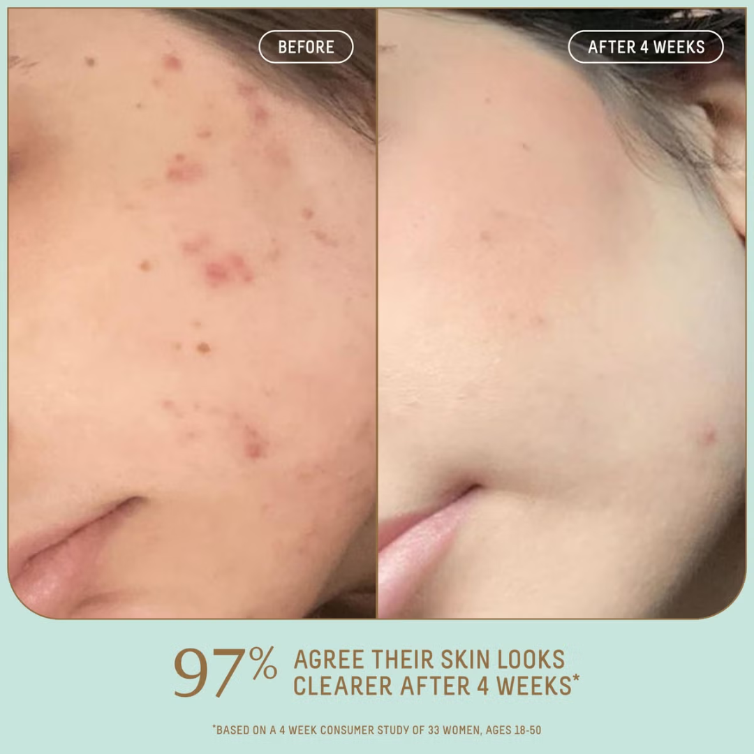 SKINTIFIC 5X Ceramide Barrier Moisture Gel | Hyaluronic Acid + Centella + Marine Collagen | Deep Hydration, Calms Redness & Repairs Skin Barrier
