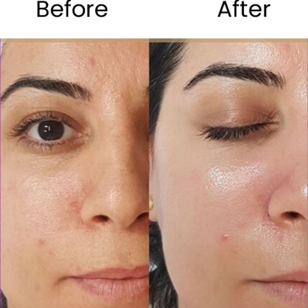 Torriden Dive In Hyaluronic Acid Serum | 5D Hyaluronic Acid Complex + Panthenol + Allantoin | 48H Deep Hydration, Soothes & Plumps Skin