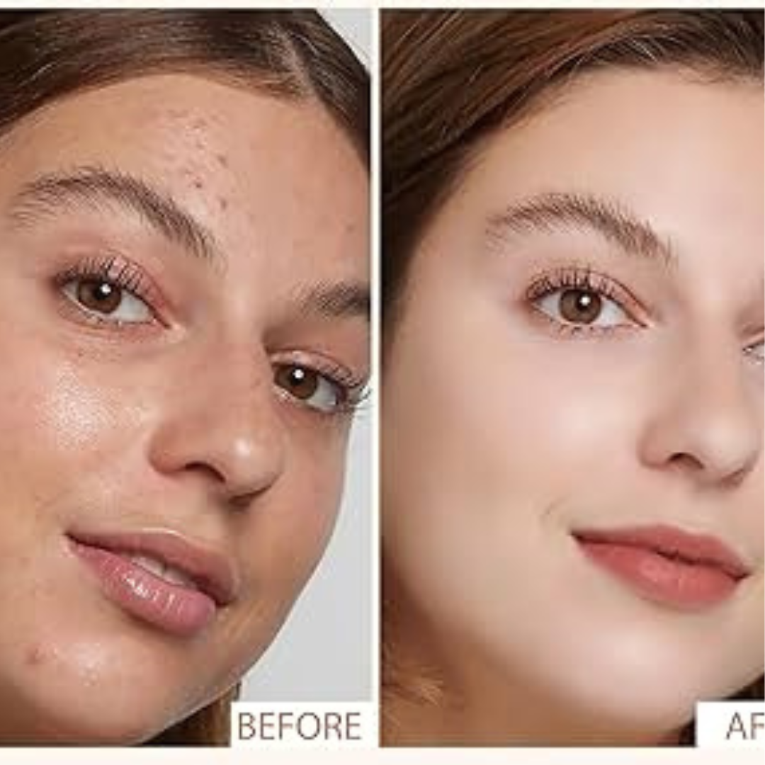 Torriden Dive In Hyaluronic Acid Serum | 5D Hyaluronic Acid Complex + Panthenol + Allantoin | 48H Deep Hydration, Soothes & Plumps Skin
