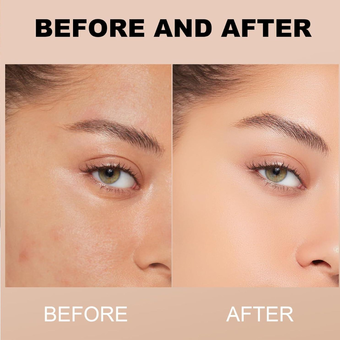 Torriden Dive In Hyaluronic Acid Serum | 5D Hyaluronic Acid Complex + Panthenol + Allantoin | 48H Deep Hydration, Soothes & Plumps Skin