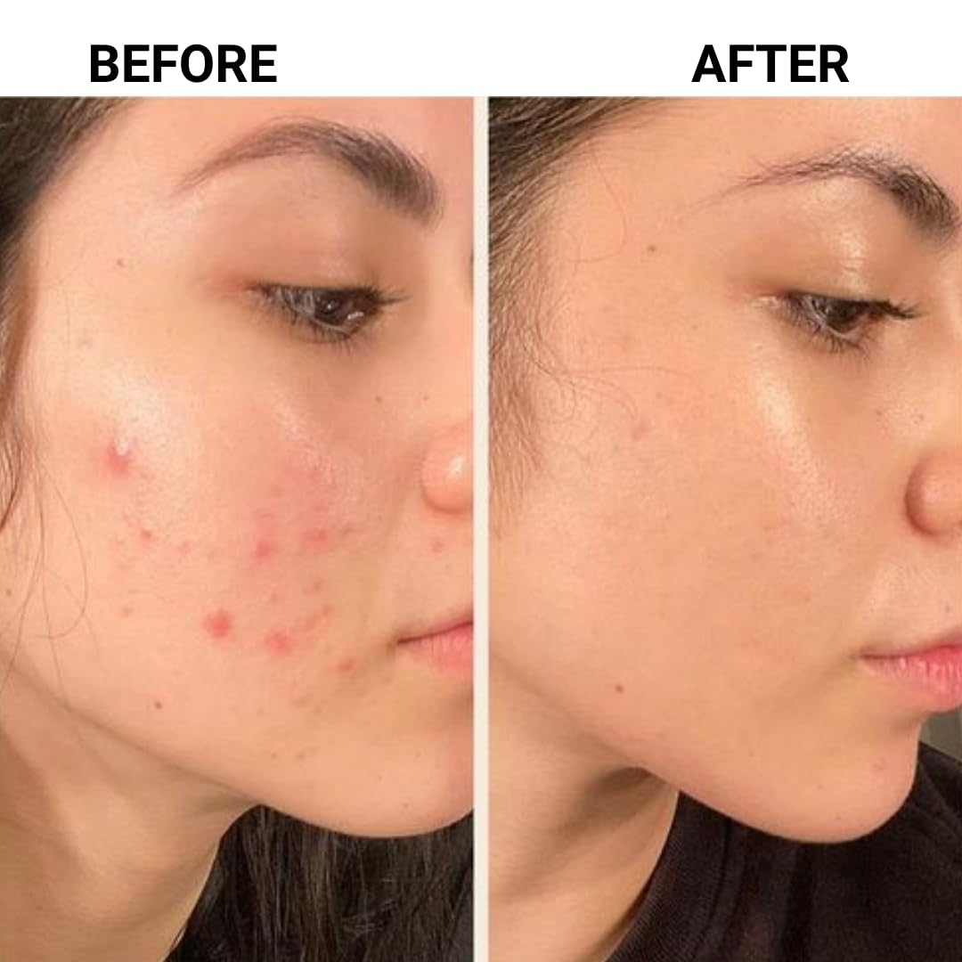 SKINTIFIC 5X Ceramide Barrier Moisture Gel | Hyaluronic Acid + Centella + Marine Collagen | Deep Hydration, Calms Redness & Repairs Skin Barrier