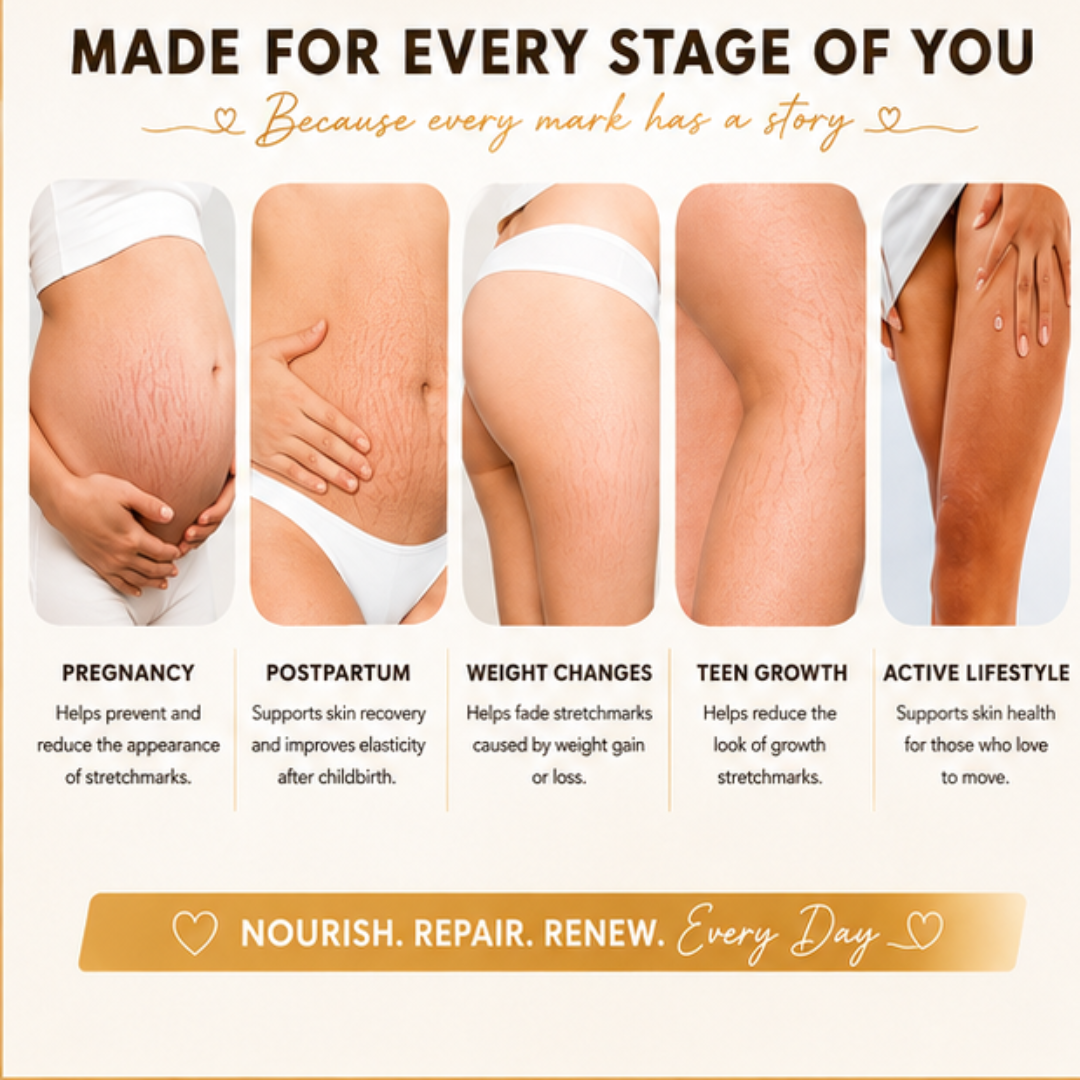 Ciara Stretchmarks Treatment Oil – Fade Stretchmarks on Belly & Thighs – With Fish Collagen – Nourish, Repair & Renew – Deeply Hydrates, Improves Elasticity – Safe for Sensitive Skin