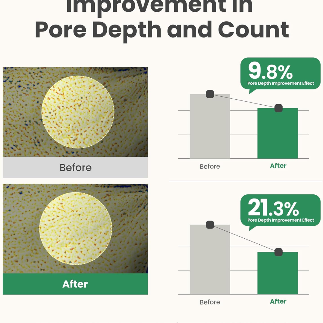 Axis-y Pore Clarifying & Acne treatment Mask | Gently clean pores & remove ance | bright & clean skin